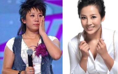 张冬玲整容前后对比照 盘一下到底变化了那些