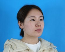 武汉美之仁价目表【武汉美之仁割眼皮案例分享】 width=