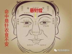怎样去除悬针纹比较好？我这整理了资料~ width=