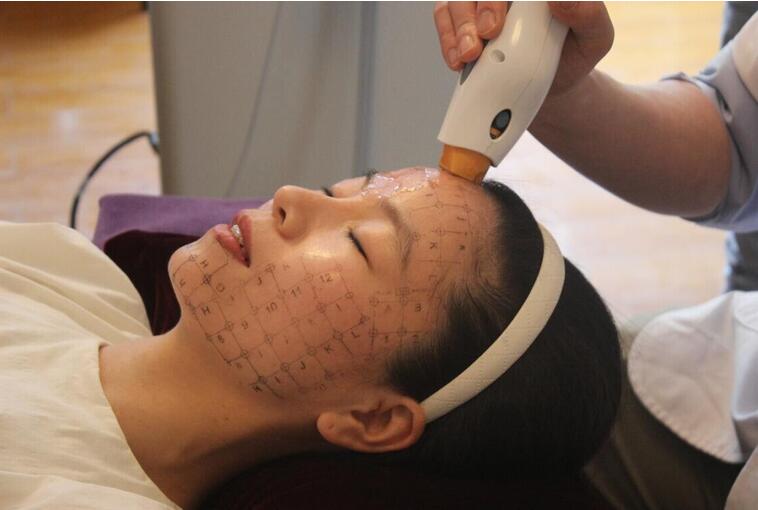 北京做热玛吉一次多少钱?贵不贵哦