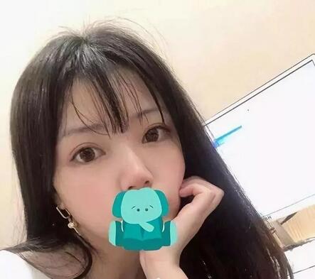 打注射瘦脸前后对比图，心机闺蜜想坑她?!
