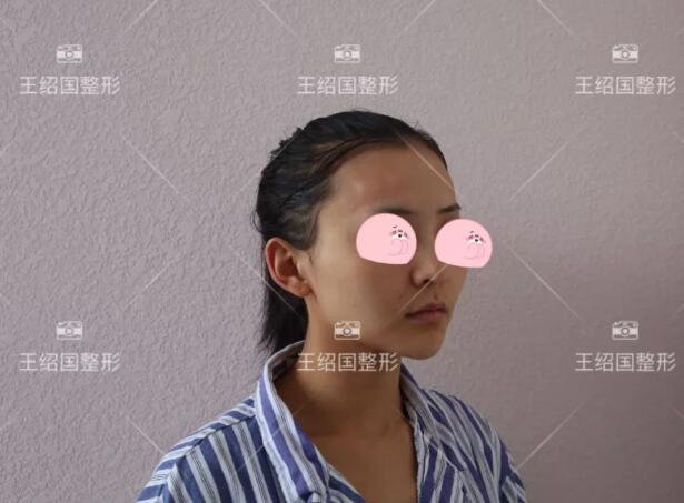 【王绍国很厉害吗|爱多邦取出案例】
