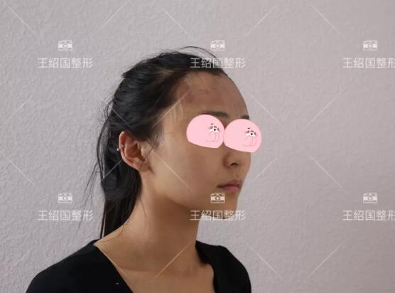【王绍国很厉害吗|爱多邦取出案例】