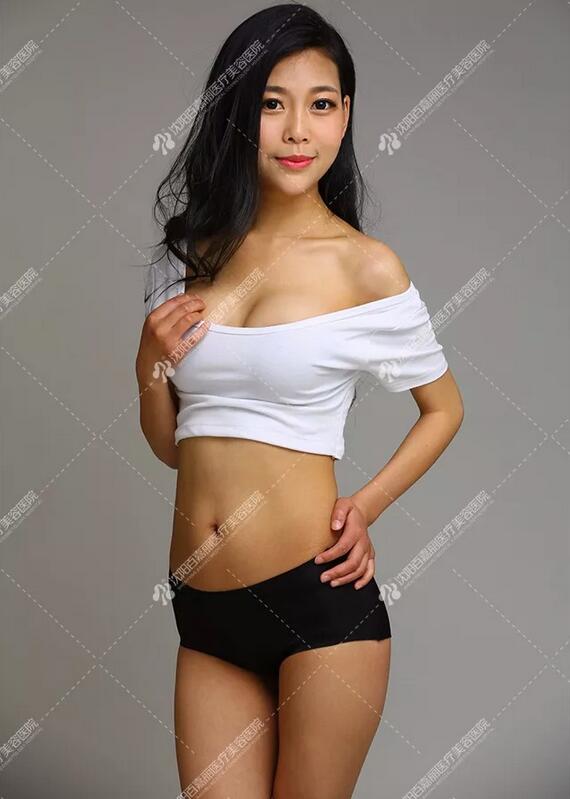 内窥镜德国vizaar威萨隆胸案例一则，你******憋拒绝！