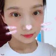 白银黛妮切开双眼皮38天惊人恢复，先天不行后天弥补的大眼睛~ width=