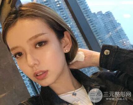 俞良钢颧骨内推