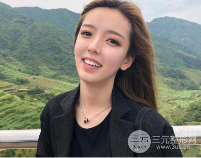 俞良钢颧骨内推