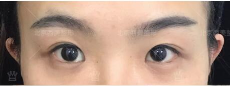 明会红美容
