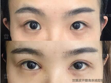 明会红美容