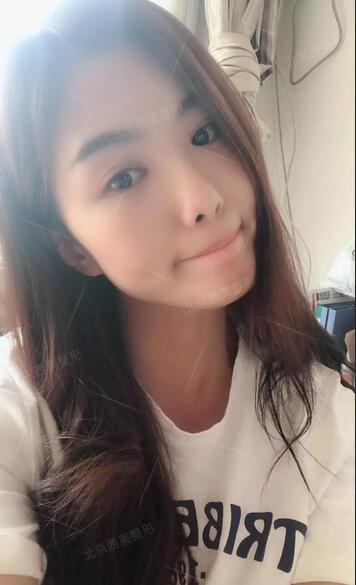 明会红美容