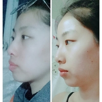 重庆牙齿矫正医院诚嘉口腔到底如何，助我再也不用捂嘴而笑