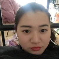 赵博士整形美容医院怎么样?******整形日记分享给大家