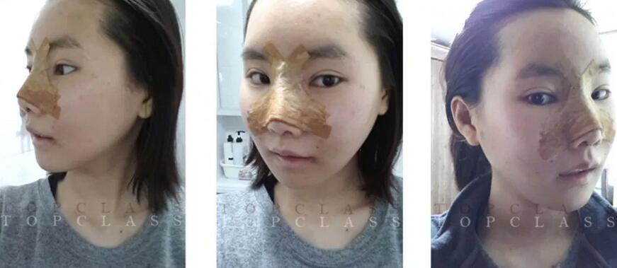 崔慧妍