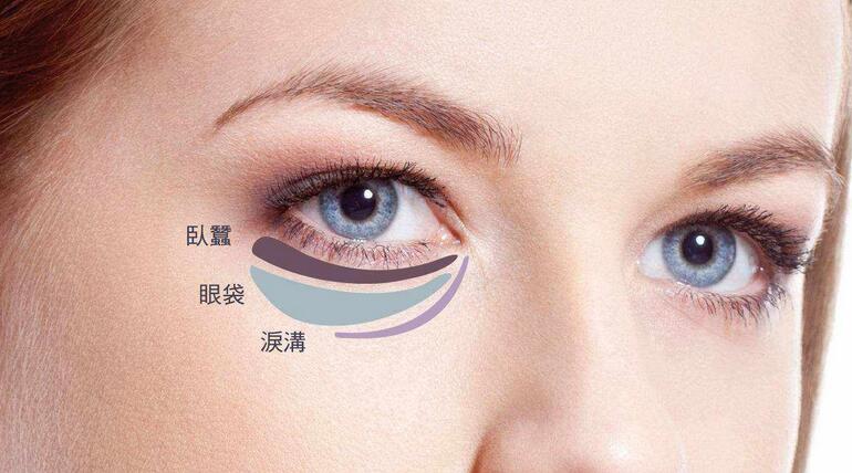 大西北祛眼袋要多少钱?