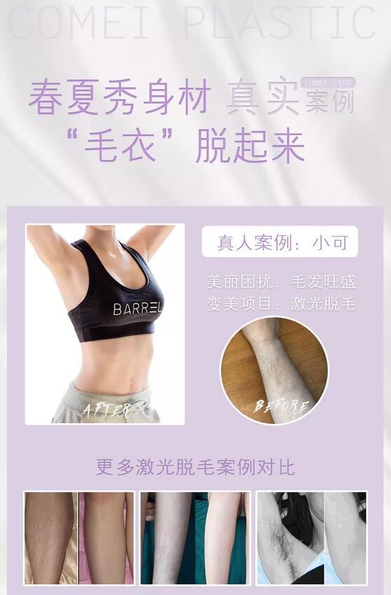 康美整形美容医院脱毛全攻略,让你不再“毛手毛脚”! 
