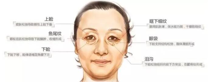 上睑下垂怎么矫正好？华美紫馨急速纳米美眼技术灰常妙！