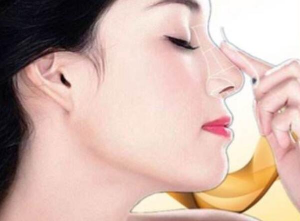 人工骨粉注射隆鼻