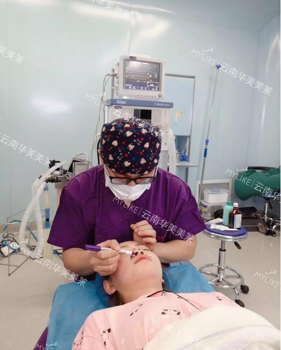 塌鼻子隆鼻前后对比