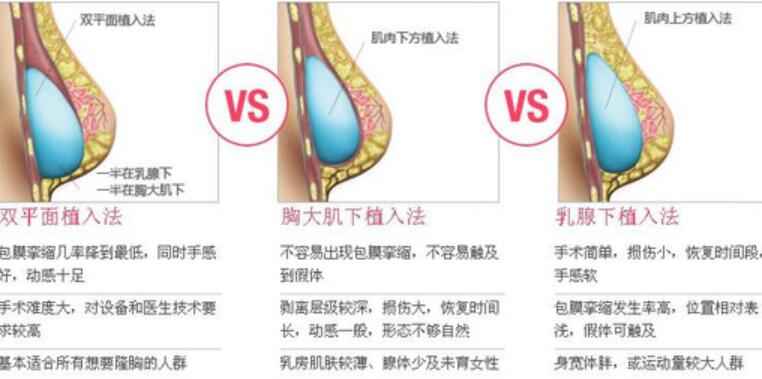 妙桃价格多少算合理呢？小编告诉你
