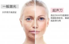 液态超声提拉的功有哪些? width=
