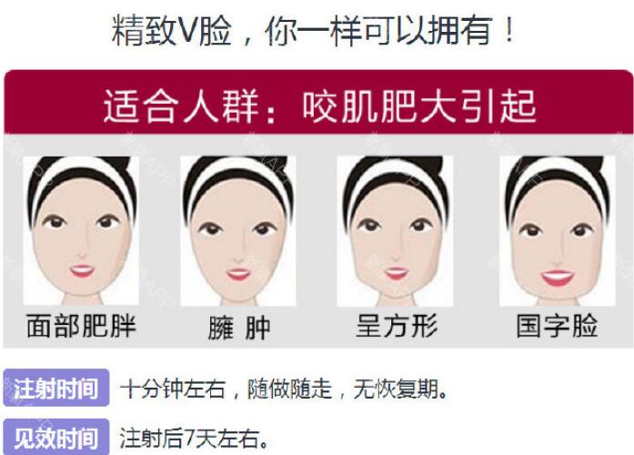 注射瘦脸进口品牌有哪些?哪个好?