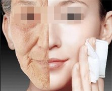 注射瘦脸生物除皱有副作用吗?是这样的~ width=
