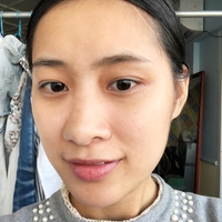 巫文云隆鼻果如何?真像广告上说的那样好?
