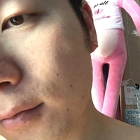 无锡DBC李艺恩院长皮肤美容技术如何?请看案例分析