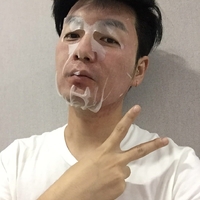 无锡DBC李艺恩院长皮肤美容技术如何?请看案例分析