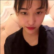 成都米兰高亮割双眼皮案例图片对比--bulingbnuling闪亮女神 width=