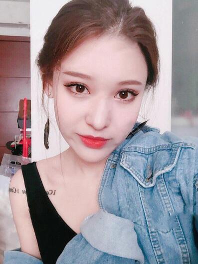 成都米兰高亮割双眼皮案例图片对比