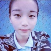 施悦韩式or欧式双眼皮案例前后对比图——粗狂少女的转型契机 width=