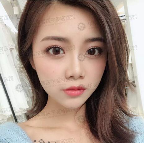 乔雅登多少钱已不是事儿|玻尿酸全场买一赠一，抓紧啦！