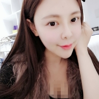 赵博士整形美容医院做隆鼻手术擅长吗?真人案例果图分享