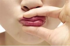 侯振杰外科正牙可信吗？侯振杰正牙案例果图一览~ width=