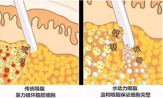 立夏养生吃什么  10种养心怡神食物要多吃