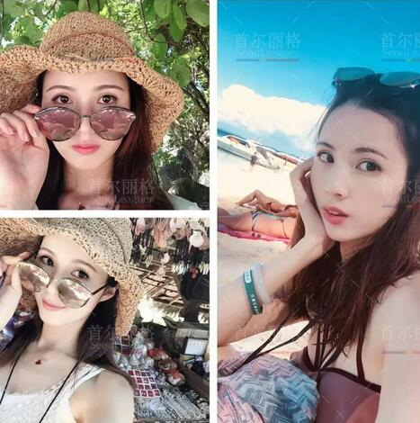 双眼皮宽度6mm恢复后是怎样的果，来看小怡的逆袭！
