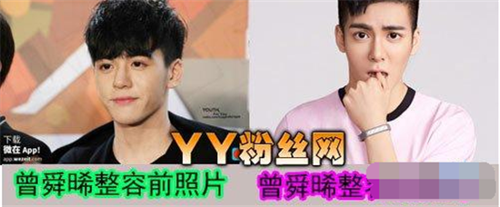 曾舜晞整容前后对比照曝光——大眼仔并非*********