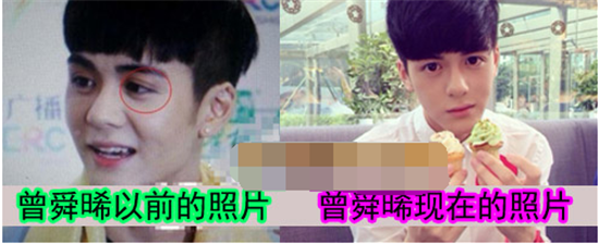曾舜晞整容前后对比照曝光——大眼仔并非*********