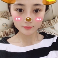 庄璐医生技术如何?庄璐医生整形案例曝光
