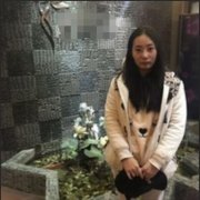 刘中国脂肪填充真实案例分享——附果图 width=