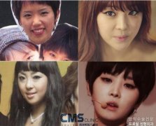 narsha整容了吗?深扒narsha变化史 width=