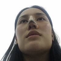沈阳杏林整形医院价格表【内附隆鼻真实案例及果图】