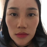 沈阳杏林整形医院价格表【内附隆鼻真实案例及果图】