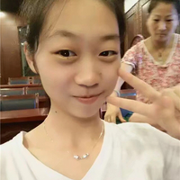 郑州东方整形医院做双眼皮怎么样?贺洁院长真实案例为你解答