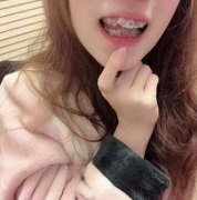 重庆诚嘉口腔医院矫正牙齿一开始收费一万八，打折下来一万三~ width=