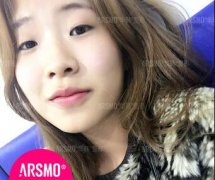 黄胜华吸雕双眼皮案例果图 恋上你的桃花眼 width=