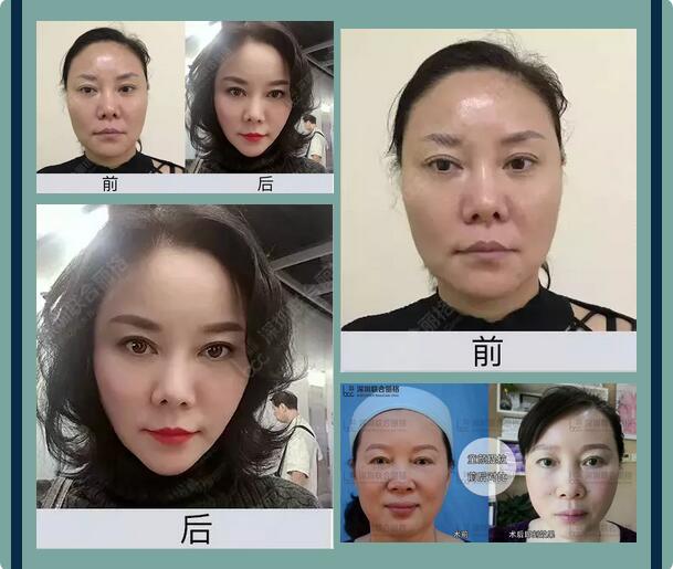 联合丽格整形医院给你一个免费变美的机会要不要？