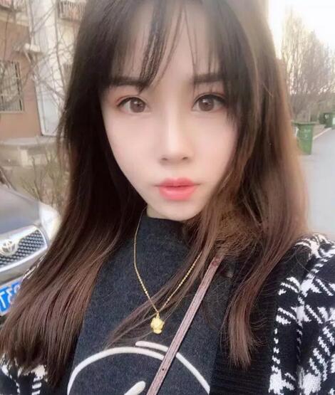 青岛诺德整形医院分段式假体隆鼻真实案例分享~