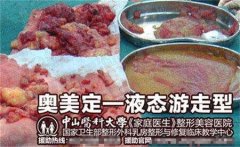 奥美定取出憋拖延，价格再高也要果断！ width=